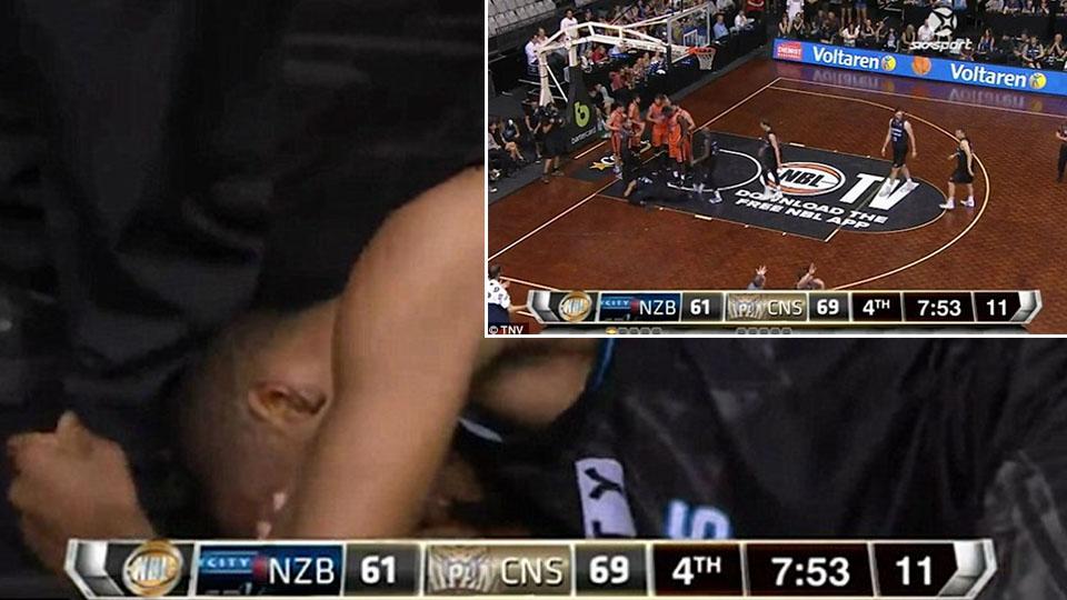 Pebasket Amerika Serikat, Akil Mitchell menderita cedera mata. - INDOSPORT